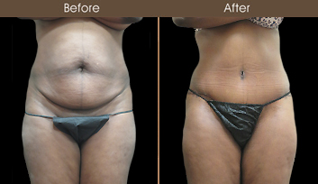 20202608154318_B178-Front-Template